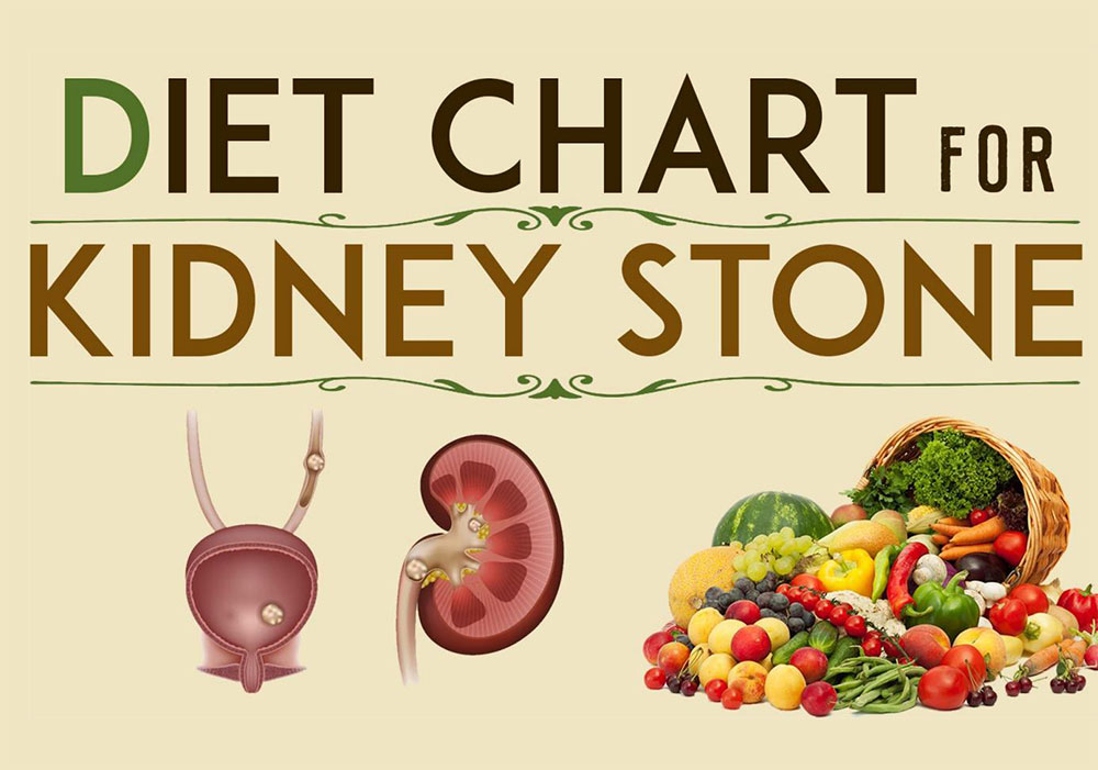 Tips for a kidney stone diet