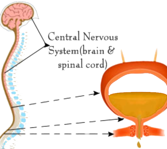 neurogenic bladder